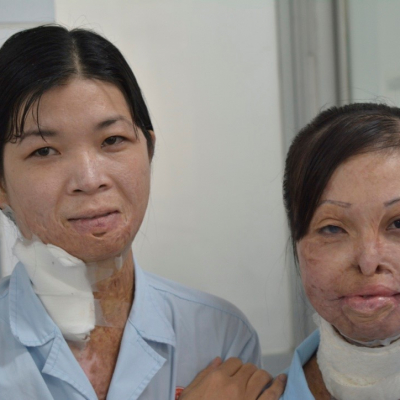 2014 Vietnam Patients 9