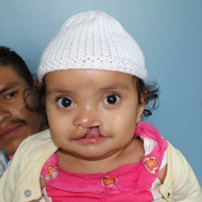 2015 Honduras Patient 2