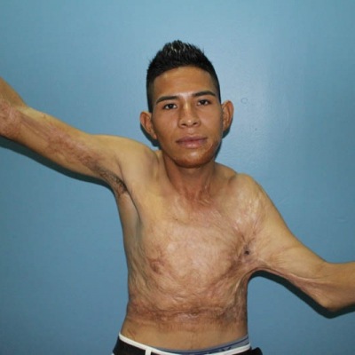 2015 Honduras Patient 4